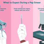 How to prepare for and interpret pap smears