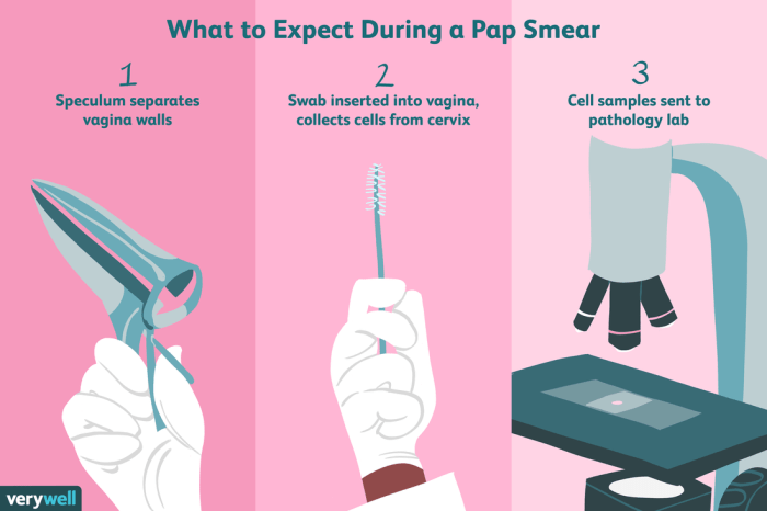 How to prepare for and interpret pap smears